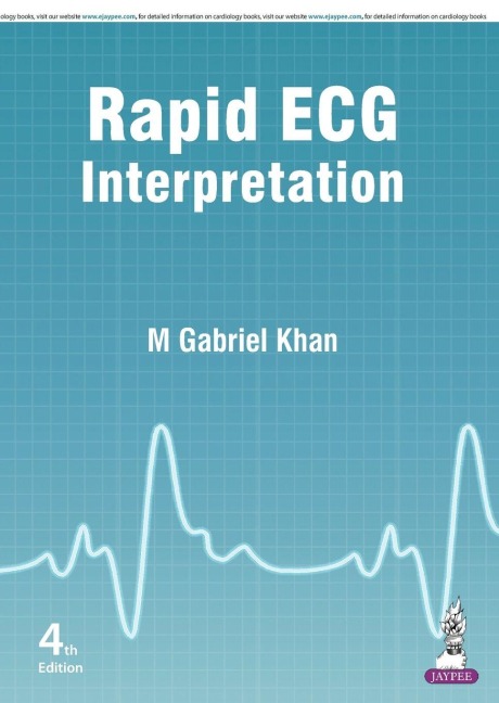 Rapid ECG Interpretation