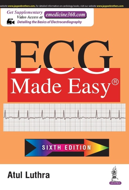 ECG Made Easy
