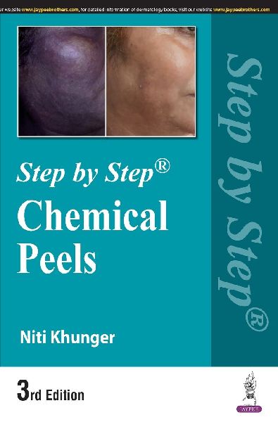 Step by Step: Chemical Peels