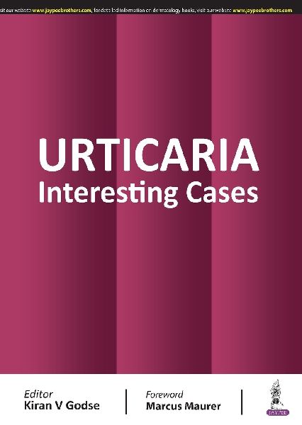 Urticaria: Interesting Cases