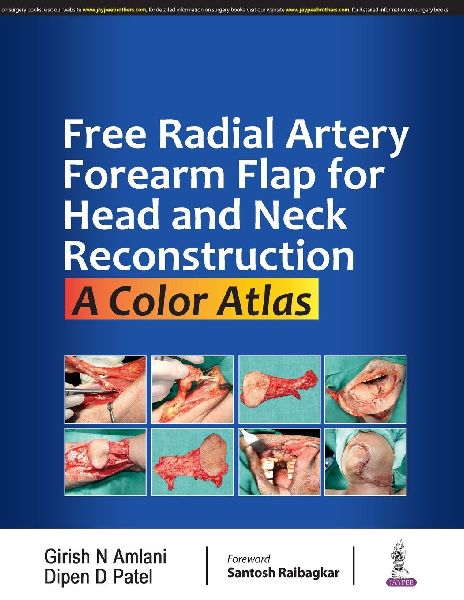 Free Radial Artery Forearm Flap for Head and Neck Reconstruction: A Color Atlas