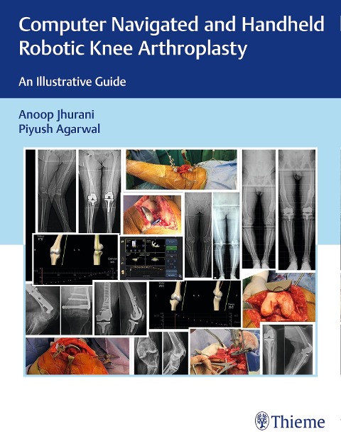 Computer Navigated and Handheld Robotic Knee Arthroplasty: An Illustrative Guide
