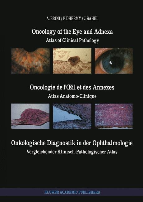 Oncology of the Eye and Adnexa / Oncologie de l¿il et des Annexes / Onkologische Diagnostik in der Ophthalmologie: Atlas of Clinical Pathology / Atlas Anatomo-Clinique / Vergleichender Klinisch-Pathologischer Atlas