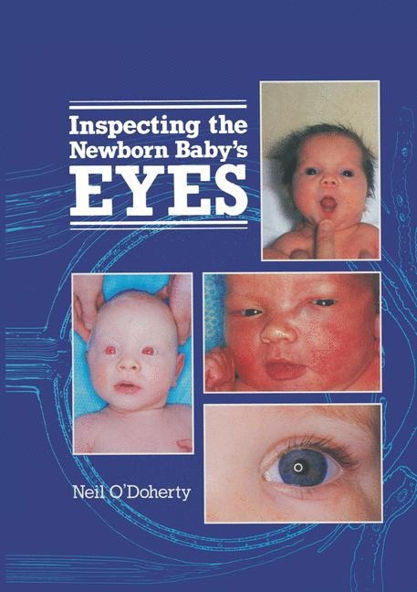 Inspecting the Newborn Babys Eyes