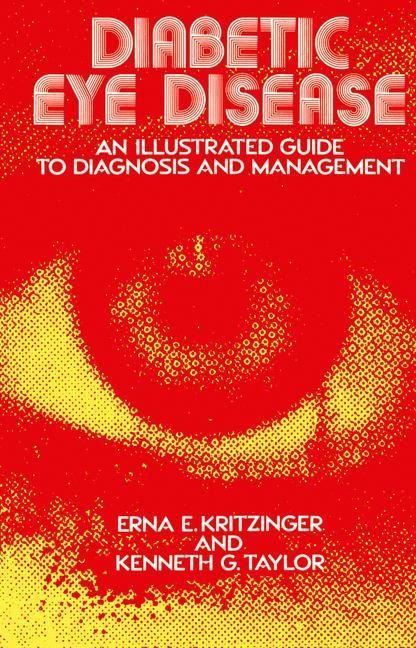 Diabetic Eye Disease: An Illustrated Guide to Diagnosis and Management