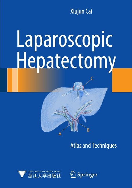Laparoscopic Hepatectomy: Atlas and Techniques
