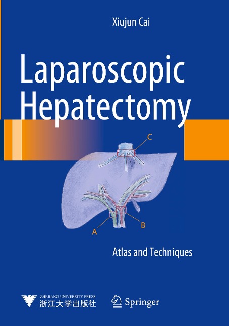 Laparoscopic Hepatectomy: Atlas and Techniques