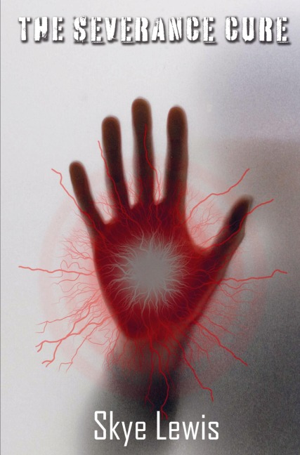 The Severance Cure: The Dome Code 3
