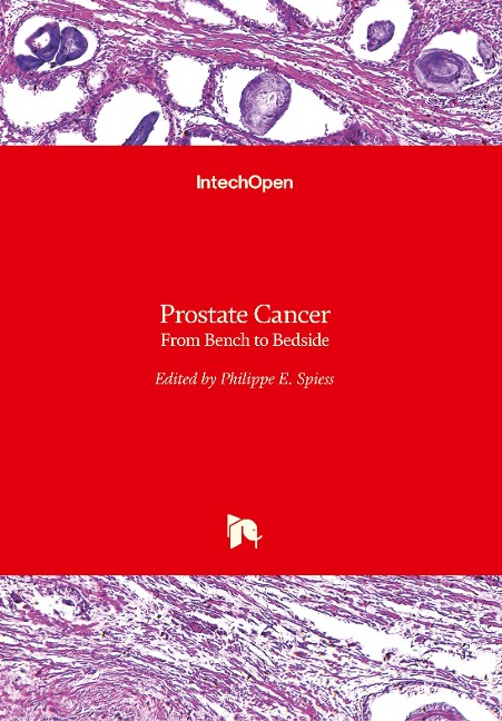 Prostate Cancer: From Bench to Bedside