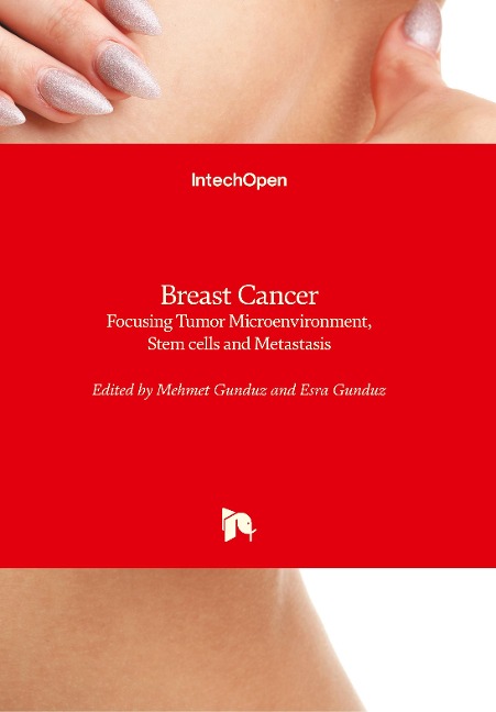 Breast Cancer: Focusing Tumor Microenvironment, Stem cells and Metastasis