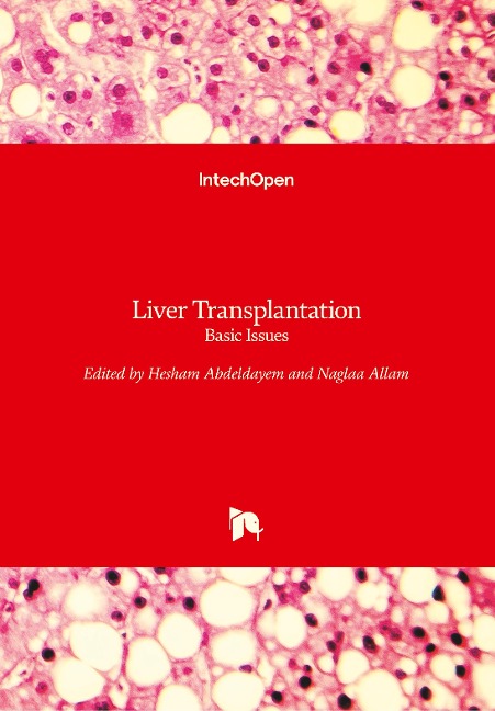 Liver Transplantation: Basic Issues