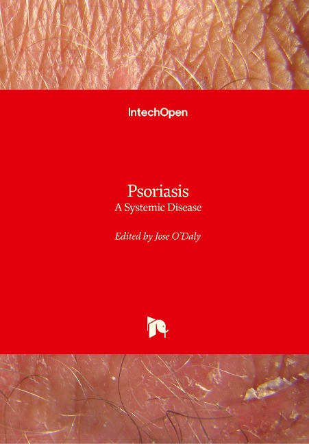 Psoriasis: A Systemic Disease