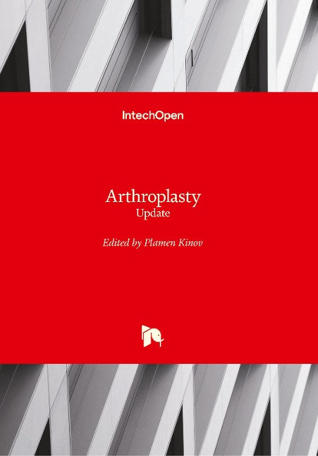 Arthroplasty: Update