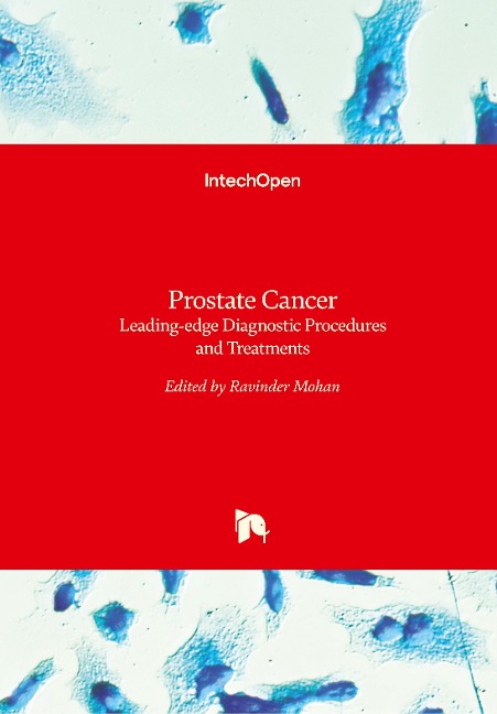 Prostate Cancer: Leading-edge Diagnostic Procedures and Treatments