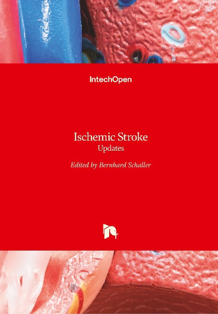 Ischemic Stroke: Updates