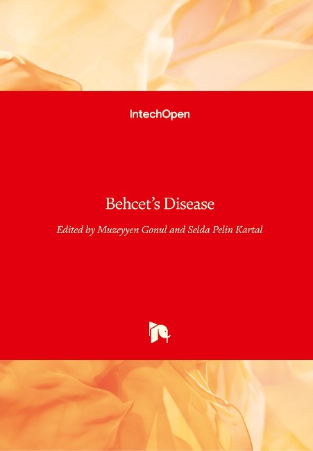 Behcets Disease