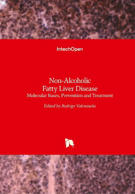 Non-Alcoholic Fatty Liver Disease: Molecular Bases, Prevention and Treatment