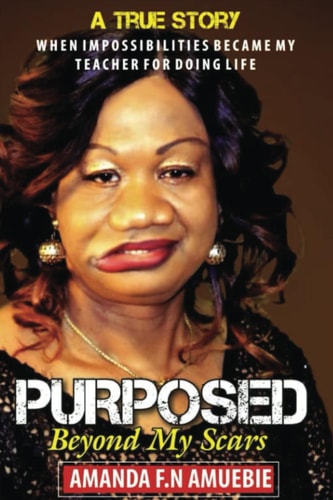 Purposed Beyond My Scars: When impossibilities Became My Teacher For Doing Life