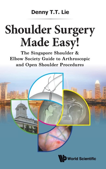SHOULDER SURGERY MADE EASY!