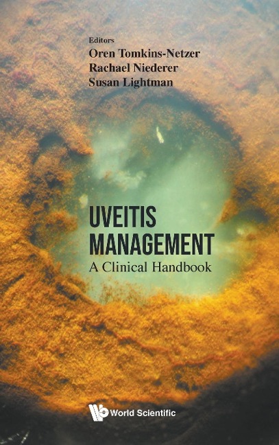 UVEITIS MANAGEMENT: A CLINICAL HANDBOOK