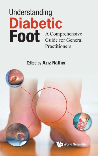 UNDERSTANDING DIABETIC FOOT