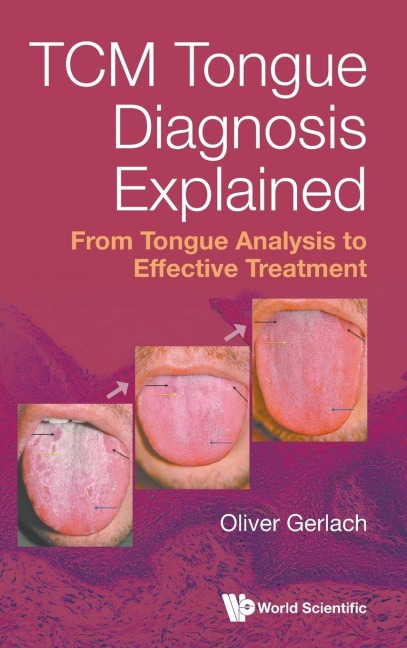 TCM TONGUE DIAGNOSIS EXPLAINED