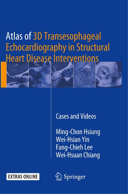 Atlas of 3D Transesophageal Echocardiography in Structural Heart Disease Interventions: Cases and Videos