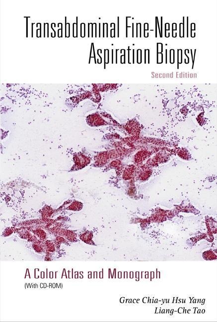 Transabdominal Fine-Needle Aspiration Biopsy (2nd Edition): A Color Atlas and Monograph