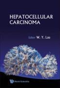 Hepatocellular Carcinoma