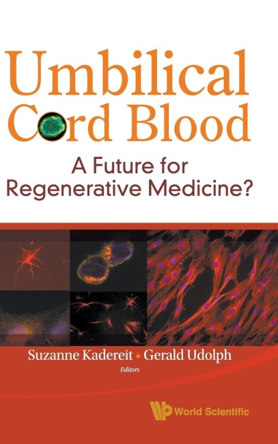 UMBILICAL CORD BLOOD