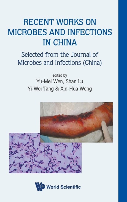 RECENT WORKS ON MICROBES & INFECTIONS...