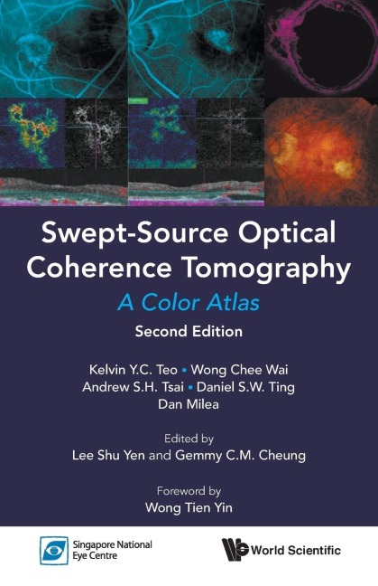 SWEPT-SOURCE OPTIC COHE (2ND ED)