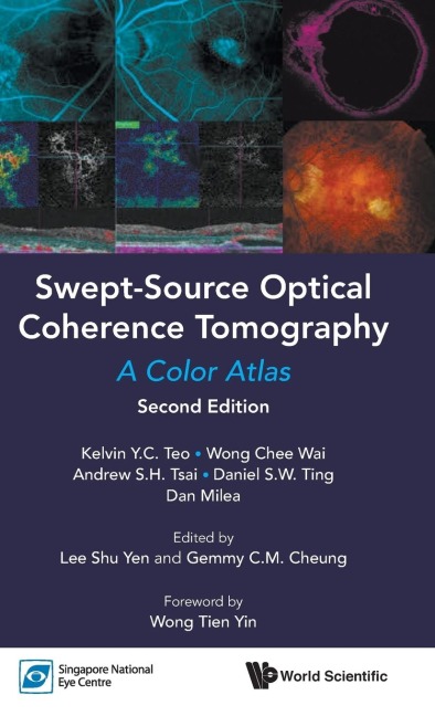 SWEPT-SOURCE OPTIC COHE (2ND ED)