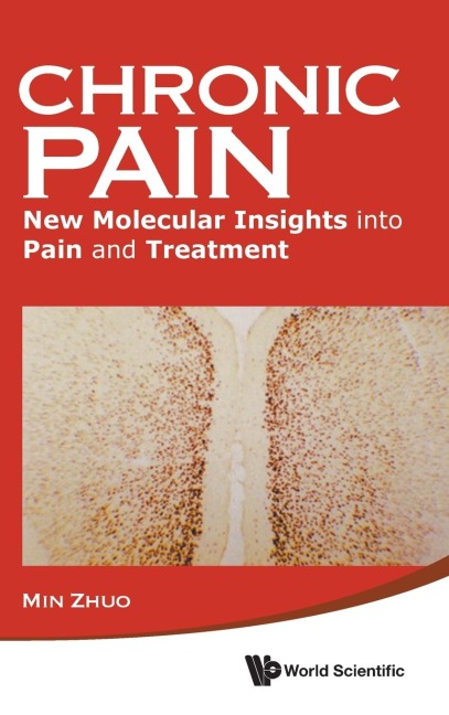 CHRONIC PAIN