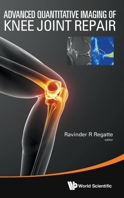 ADVANCED QUANTITATIVE IMAGING OF KNEE JOINT REPAIR
