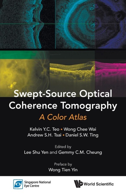 SWEPT-SOURCE OPTICAL COHERENCE TOMOGRAPHY: A COLOR ATLAS