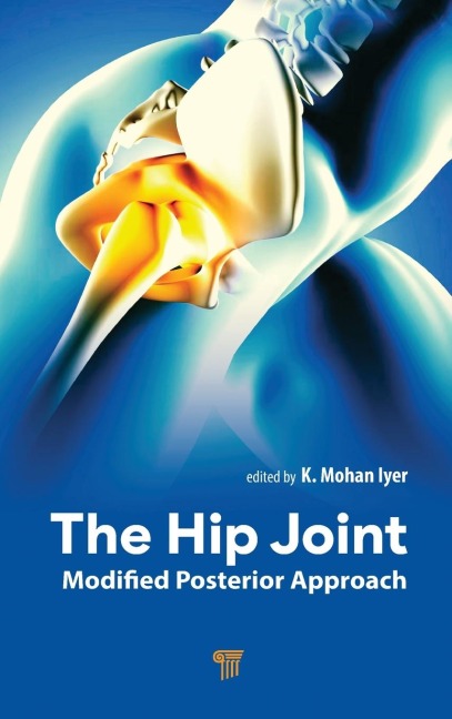 The Hip Joint: Modified Posterior Approach