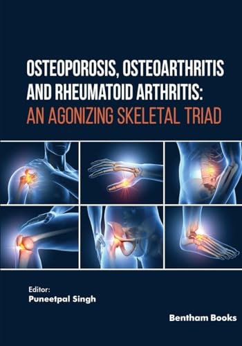 Osteoporosis, Osteoarthritis and Rheumatoid Arthritis An Agonizing Skeletal Triad