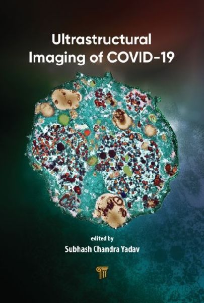 Ultrastructural Imaging of COVID-19