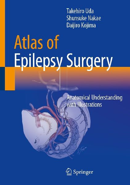 Atlas of Epilepsy Surgery: Anatomical Understanding with Illustrations