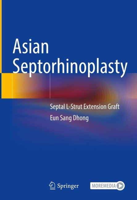 Asian Septorhinoplasty: Septal L-Strut Extension Graft
