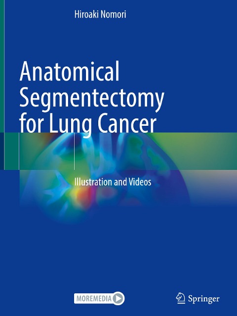 Anatomical Segmentectomy for Lung Cancer: Illustration and Videos