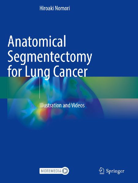 Anatomical Segmentectomy for Lung Cancer: Illustration and Videos