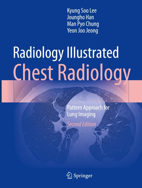 Radiology Illustrated: Chest Radiology: Pattern Approach for Lung Imaging