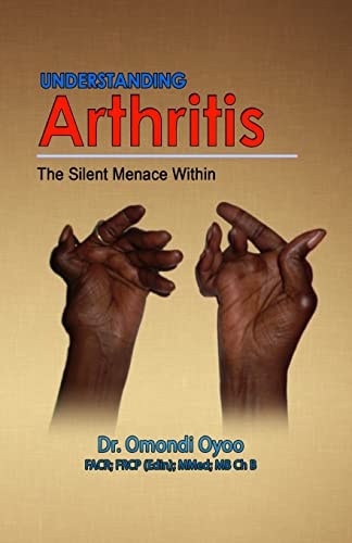 Understanding Arthritis The Silent Menace Within