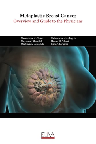 Metaplastic Breast Cancer Overview and Guide to the Physicians