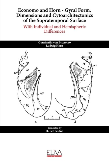 Economo and Horn - Gyral Form, Dimensions and Cytoarchitectonics of the Supratemporal Surface