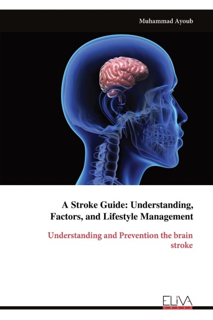 A Stroke Guide: Understanding,Factors, and Lifestyle Management: Understanding and Prevention the brainstroke