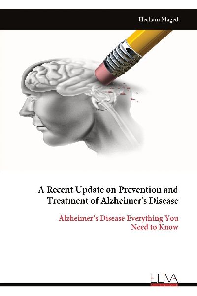 A Recent Update on Prevention and Treatment of Alzheimers Disease