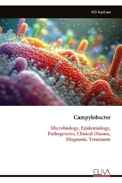Campylobacter: Microbiology, Epidemiology, Pathogenesis, Clinical Disease, Diagnosis, Treatment